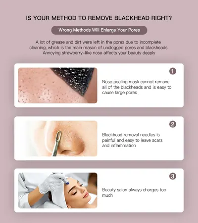 Blackhead Remover — Beauty & Hair Care product photo 12 of 12, OEM and private label supply