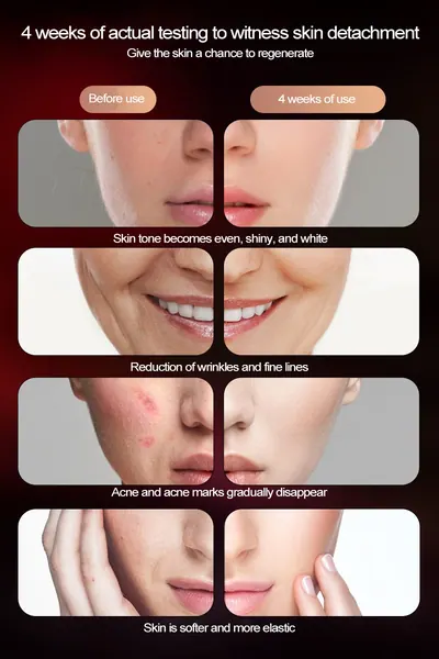 Beauty Eye Device — Beauty & Hair Care product photo 3 of 3, OEM and private label supply