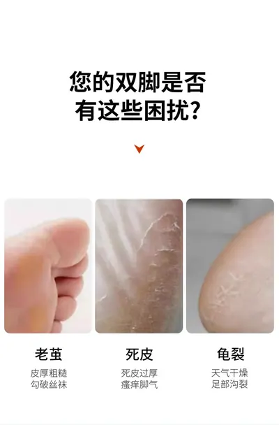 Callus Remover YZ-978 — Personal Care product photo 8 of 12, OEM and private label supply