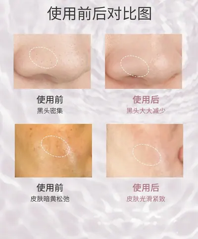 Ultrasonic Ion Beauty Device 7C-CPY-02 — Beauty & Hair Care product photo 9 of 10, OEM and private label supply